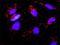 Fibroblast Growth Factor 8 antibody, H00002253-M05, Novus Biologicals, Proximity Ligation Assay image 