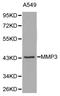 Matrix Metallopeptidase 3 antibody, LS-C192463, Lifespan Biosciences, Western Blot image 