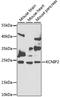 Potassium Voltage-Gated Channel Interacting Protein 2 antibody, A7100, ABclonal Technology, Western Blot image 