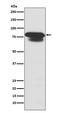Protein Inhibitor Of Activated STAT 1 antibody, M01707, Boster Biological Technology, Western Blot image 
