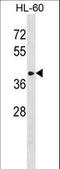 ST8 Alpha-N-Acetyl-Neuraminide Alpha-2,8-Sialyltransferase 6 antibody, LS-C161536, Lifespan Biosciences, Western Blot image 