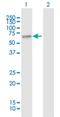 S27A1 antibody, H00376497-B01P, Novus Biologicals, Western Blot image 