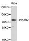 Phosphoinositide-3-Kinase Regulatory Subunit 2 antibody, STJ112945, St John
