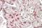 MAX Dimerization Protein MLX antibody, NBP1-46146, Novus Biologicals, Immunohistochemistry frozen image 