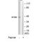 Splicing Factor 3b Subunit 4 antibody, TA315039, Origene, Western Blot image 