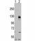 Transient Receptor Potential Cation Channel Subfamily M Member 8 antibody, F51113-0.4ML, NSJ Bioreagents, Western Blot image 