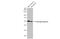 Fibrinogen Gamma Chain antibody, GTX636835, GeneTex, Western Blot image 