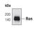 Macrophage Stimulating 1 Receptor antibody, MA5-14931, Invitrogen Antibodies, Western Blot image 