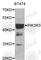 Phosphoinositide-3-Kinase Regulatory Subunit 3 antibody, A7942, ABclonal Technology, Western Blot image 