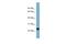 RAB22A, Member RAS Oncogene Family antibody, NBP1-56889, Novus Biologicals, Western Blot image 