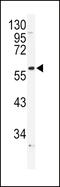 Adrenoceptor Alpha 1B antibody, 63-929, ProSci, Western Blot image 