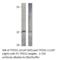 Tumor protein D52 antibody, TPD52-112AP, FabGennix, Western Blot image 