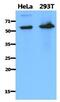 PDZ Domain Containing 1 antibody, GTX53760, GeneTex, Western Blot image 