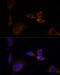 Protein Kinase C Delta antibody, 13-180, ProSci, Immunofluorescence image 