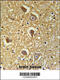 Hyaluronan synthase 2 antibody, OAAB03095, Aviva Systems Biology, Immunohistochemistry frozen image 