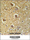 Hyaluronan Synthase 2 antibody, OAAB03095, Aviva Systems Biology, Immunohistochemistry frozen image 