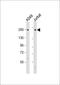 Collagen Type XI Alpha 1 Chain antibody, MBS9215681, MyBioSource, Western Blot image 