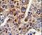 CD38 Molecule antibody, PA5-12509, Invitrogen Antibodies, Immunohistochemistry frozen image 