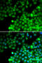 Transgelin 2 antibody, STJ28844, St John