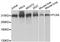 Filamin A antibody, A0927, ABclonal Technology, Western Blot image 