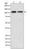 Mov10 RISC Complex RNA Helicase antibody, M04952, Boster Biological Technology, Western Blot image 