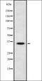 C-C chemokine receptor type 8 antibody, orb336393, Biorbyt, Western Blot image 