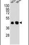 Keratin 80 antibody, PA5-24360, Invitrogen Antibodies, Western Blot image 