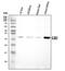 Connexin-26 antibody, A00512-1, Boster Biological Technology, Western Blot image 