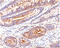 Carcinoembryonic Antigen Related Cell Adhesion Molecule 5 antibody, AM33275PU-S, Origene, Immunohistochemistry frozen image 