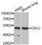 Calumenin antibody, STJ28621, St John