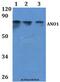 Anoctamin 1 antibody, LS-C412062, Lifespan Biosciences, Western Blot image 