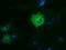 Dynein Cytoplasmic 1 Light Intermediate Chain 1 antibody, LS-C115572, Lifespan Biosciences, Immunofluorescence image 