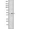 CD209 Molecule antibody, abx146678, Abbexa, Western Blot image 