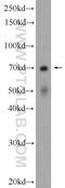 Ectonucleoside triphosphate diphosphohydrolase 2 antibody, 13656-1-AP, Proteintech Group, Western Blot image 