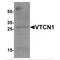 V-Set Domain Containing T Cell Activation Inhibitor 1 antibody, MBS153564, MyBioSource, Western Blot image 