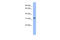 T Cell Leukemia Homeobox 1 antibody, ARP38630_P050, Aviva Systems Biology, Western Blot image 