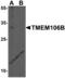 Transmembrane Protein 106B antibody, 6783, ProSci Inc, Western Blot image 