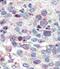 Snail Family Transcriptional Repressor 1 antibody, PA5-11923, Invitrogen Antibodies, Immunohistochemistry frozen image 