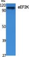 Eukaryotic Elongation Factor 2 Kinase antibody, A02277, Boster Biological Technology, Western Blot image 