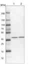 5-Phosphohydroxy-L-Lysine Phospho-Lyase antibody, NBP1-81190, Novus Biologicals, Western Blot image 