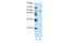 Zinc Finger Protein 382 antibody, 29-118, ProSci, Western Blot image 