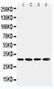 SOD3 antibody, PA1899, Boster Biological Technology, Western Blot image 