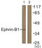Ephrin B1 antibody, LS-C117889, Lifespan Biosciences, Western Blot image 