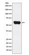 LCK Proto-Oncogene, Src Family Tyrosine Kinase antibody, M00425, Boster Biological Technology, Western Blot image 