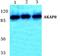 A-Kinase Anchoring Protein 8 antibody, PA5-36921, Invitrogen Antibodies, Western Blot image 