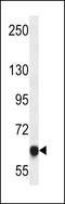 MAGE Family Member D4B antibody, LS-C163971, Lifespan Biosciences, Western Blot image 