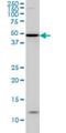 Iroquois Homeobox 5 antibody, H00010265-M01, Novus Biologicals, Western Blot image 