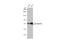 Calpain 2 antibody, GTX111809, GeneTex, Western Blot image 