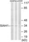 Siah E3 Ubiquitin Protein Ligase 1 antibody, LS-C119130, Lifespan Biosciences, Western Blot image 