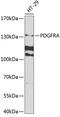 Platelet Derived Growth Factor Receptor Alpha antibody, 18-503, ProSci, Western Blot image 